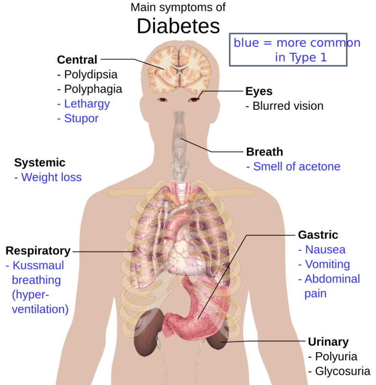 main symptoms of diabetes