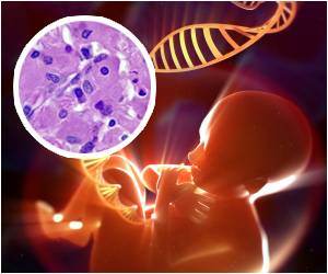 Neonatal Genetics