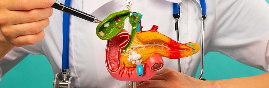 How Pancreatitis Leads to Type 3c Diabetes