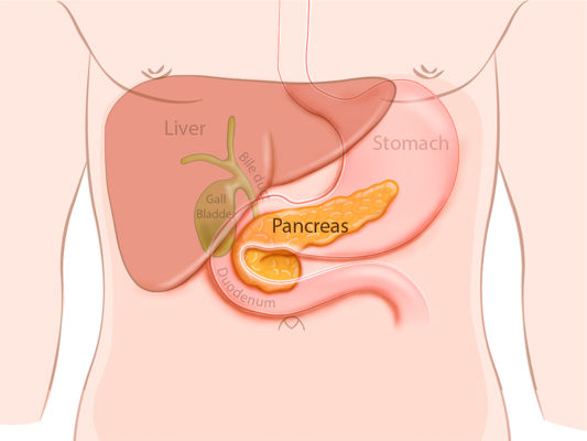 How Pancreatic Hormone Imbalance Leads to Type 3c Diabetes