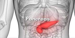 How Pancreatic Enzyme Insufficiency Causes Digestive Issues in Type 3c Diabetes