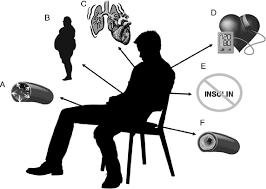 How Sedentary Behavior Impacts MODY Diabetes Risk