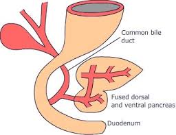 How Delayed Pancreatic Development Leads to Neonatal Diabetes