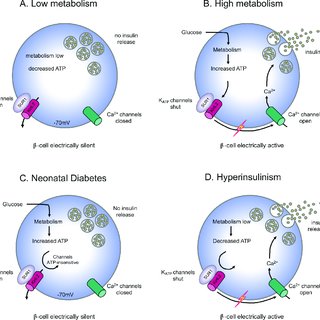 How Impaired Glucose Metabolism Triggers Neonatal Diabetes