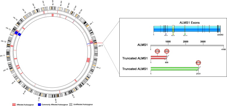 How Genetic Mutations in ALMS1 Affect Retinal Cells in Alström Syndrome