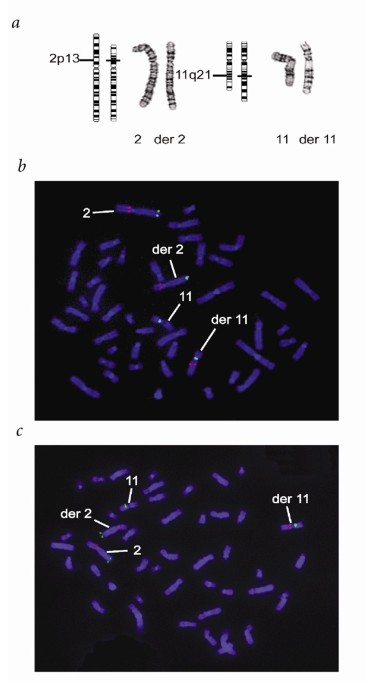 How ALMS1 Mutations Contribute to Cardiomyopathy in Alström Syndrome