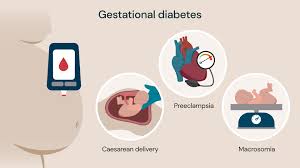 How Hormones Contribute to Gestational Diabetes