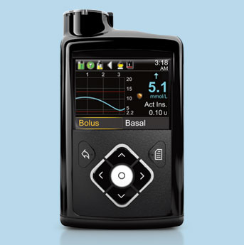 what is the Hype Surrounding Insulin Pumps