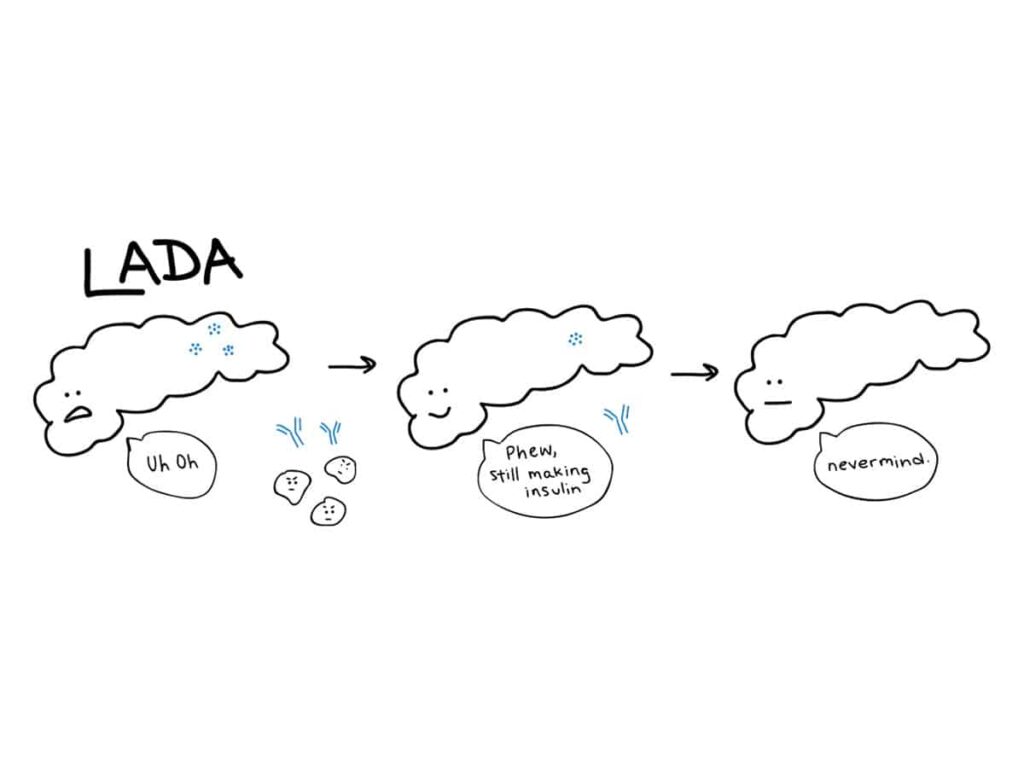 Understanding the link between LADA and Autoimmunity