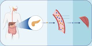Type 2 Diabetes and Impaired Glucose Metabolism