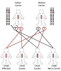 FAQs on Genetic Mutations in the ALMS1 Gene & Alström Syndrome
